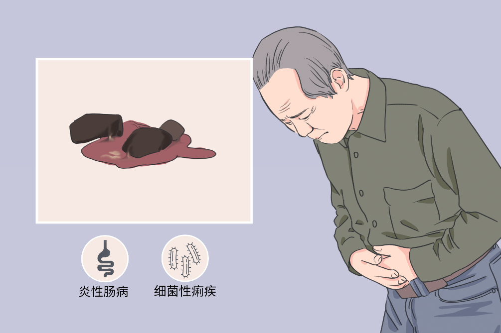 有血液和脓状物质,主要是肠道存在炎症或受外界刺激所致,如细菌性痢疾