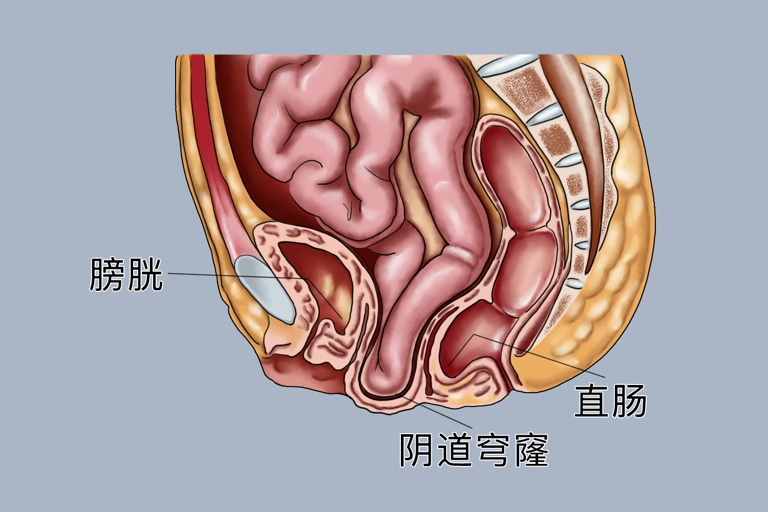 阴道穹隆部位图