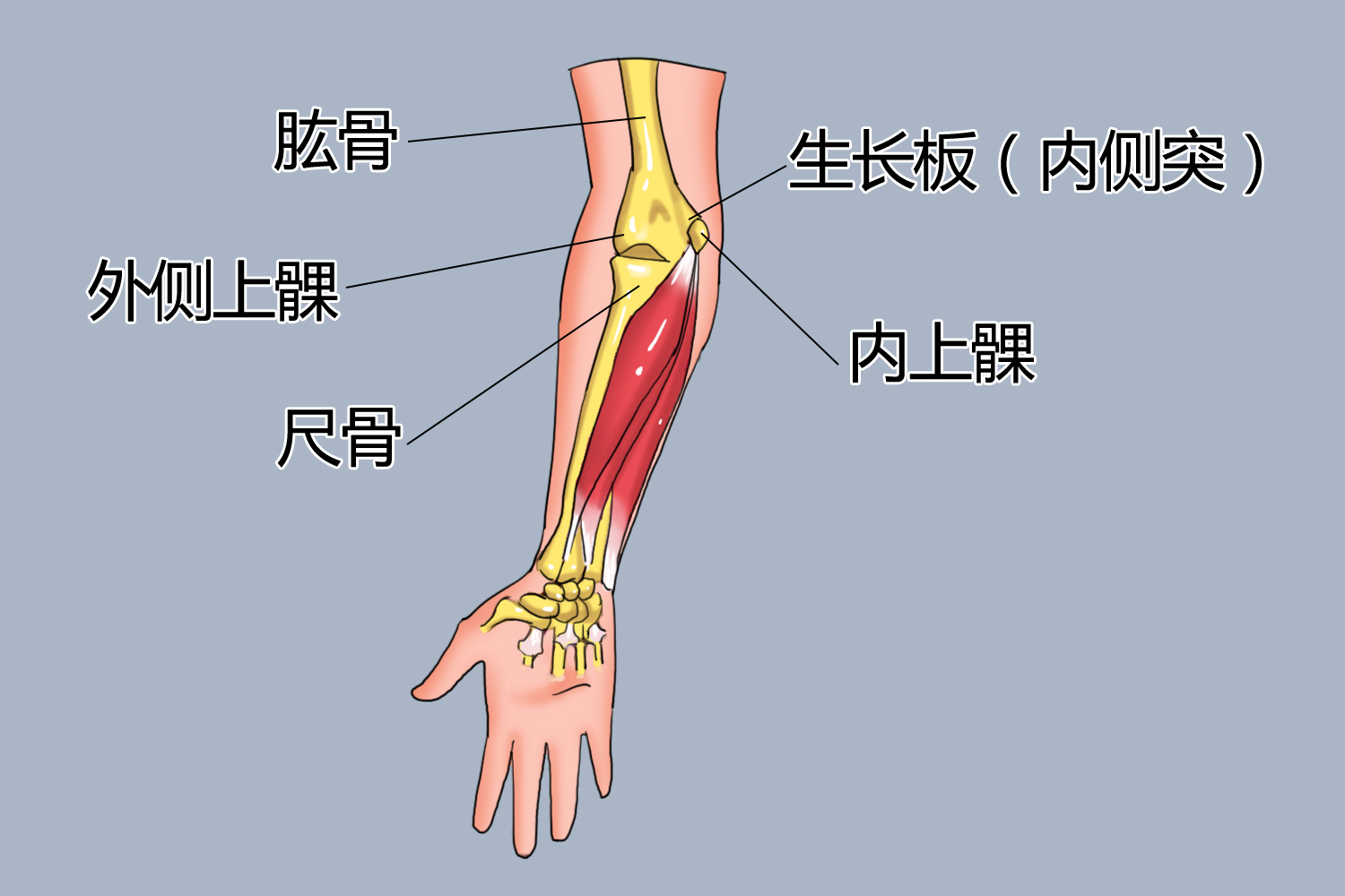 肱骨外上髁、内上髁手绘图 肱骨外上髁、内上髁手绘图