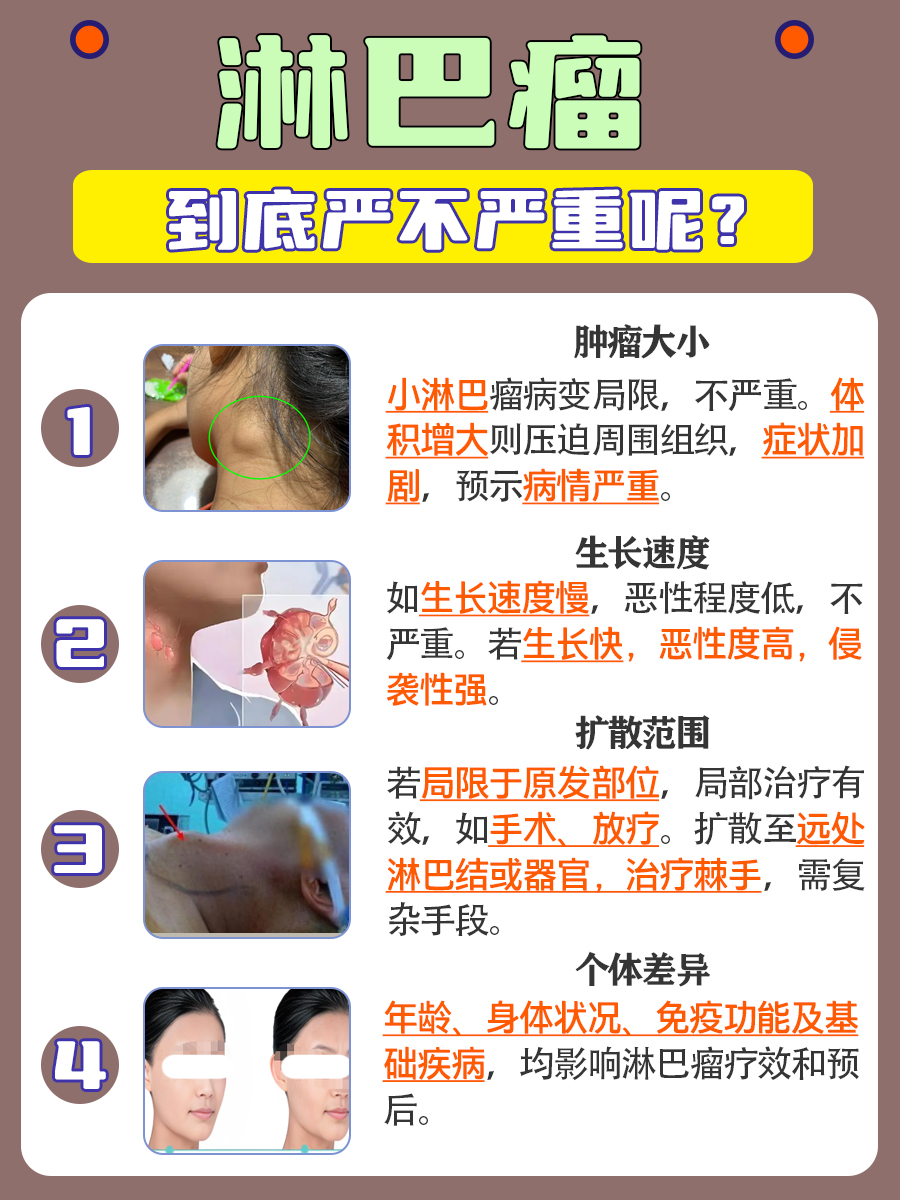 淋巴瘤:病情轻重,你知道吗?