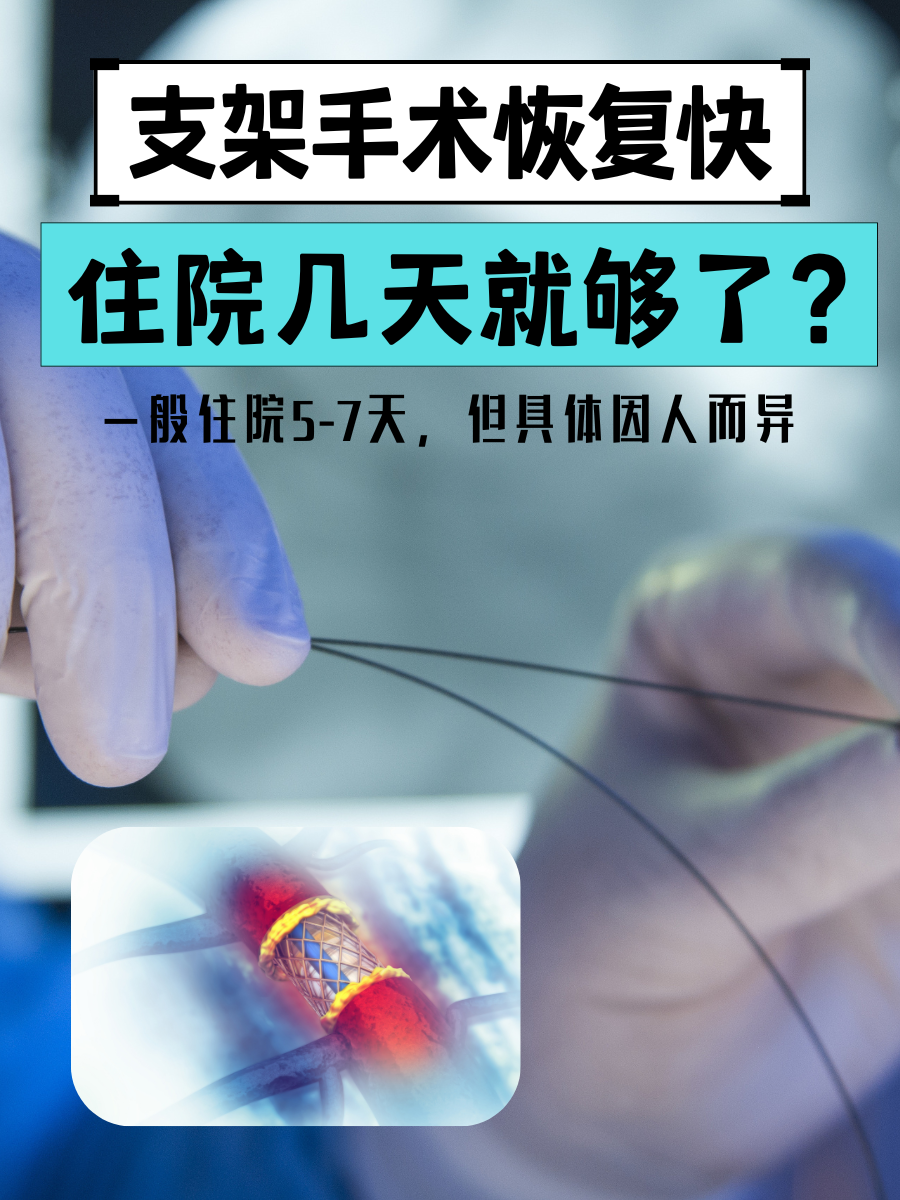 支架手术恢复快，住院几天就够了？