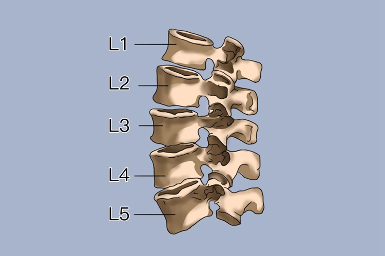 l4椎体图