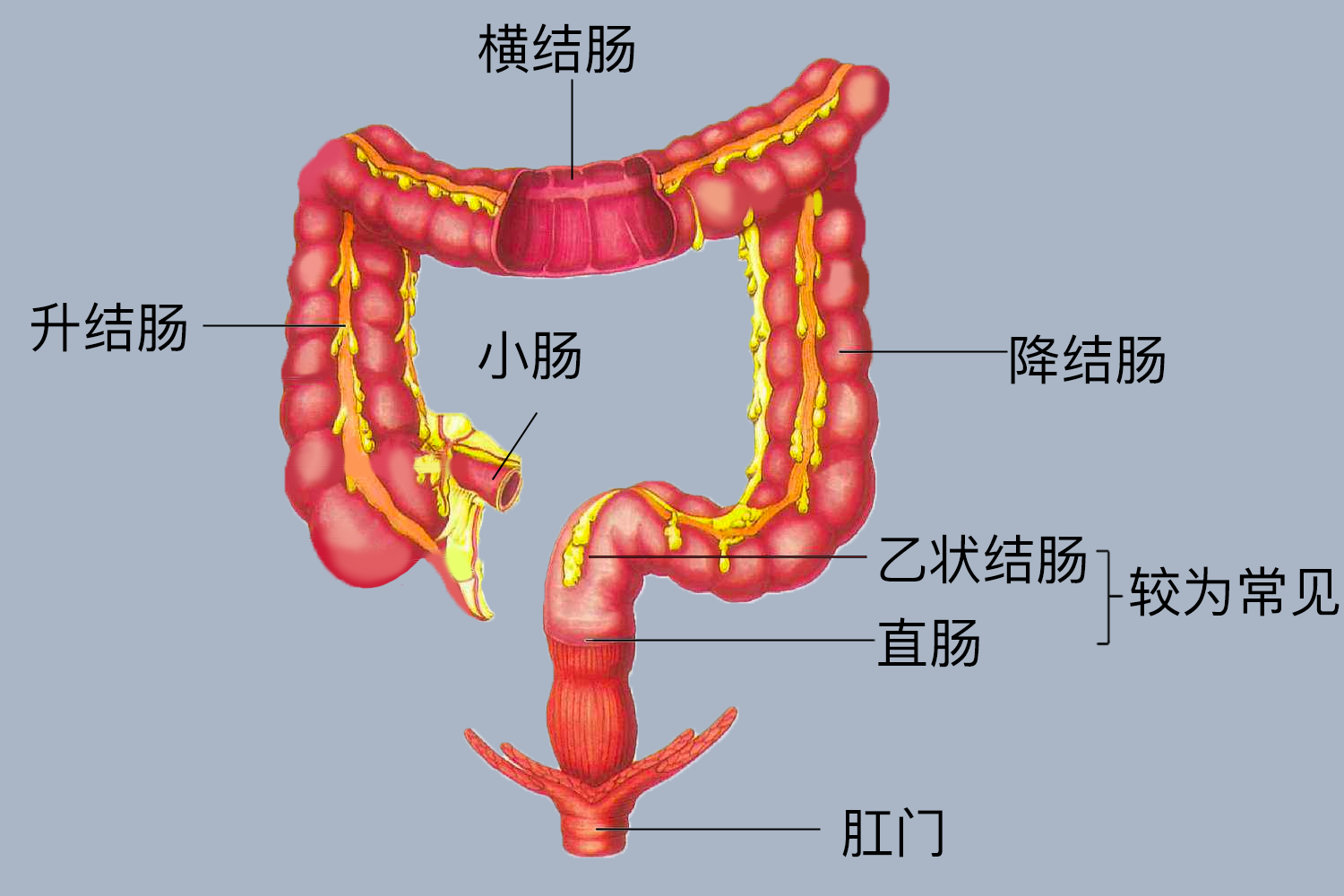 溃疡性结肠炎好发部位图