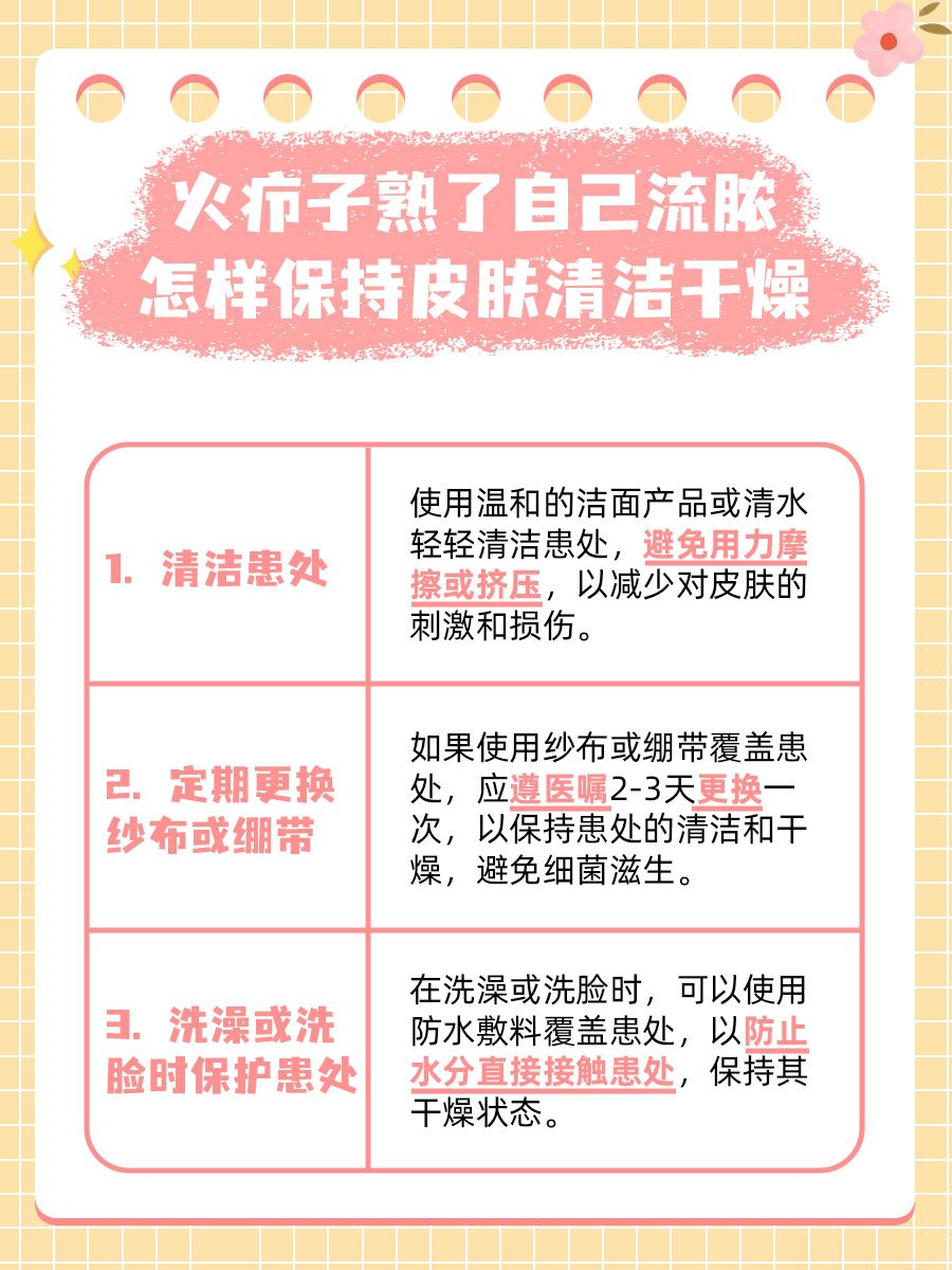 火疖子熟了自己流脓还手动挤吗?看完你就懂!