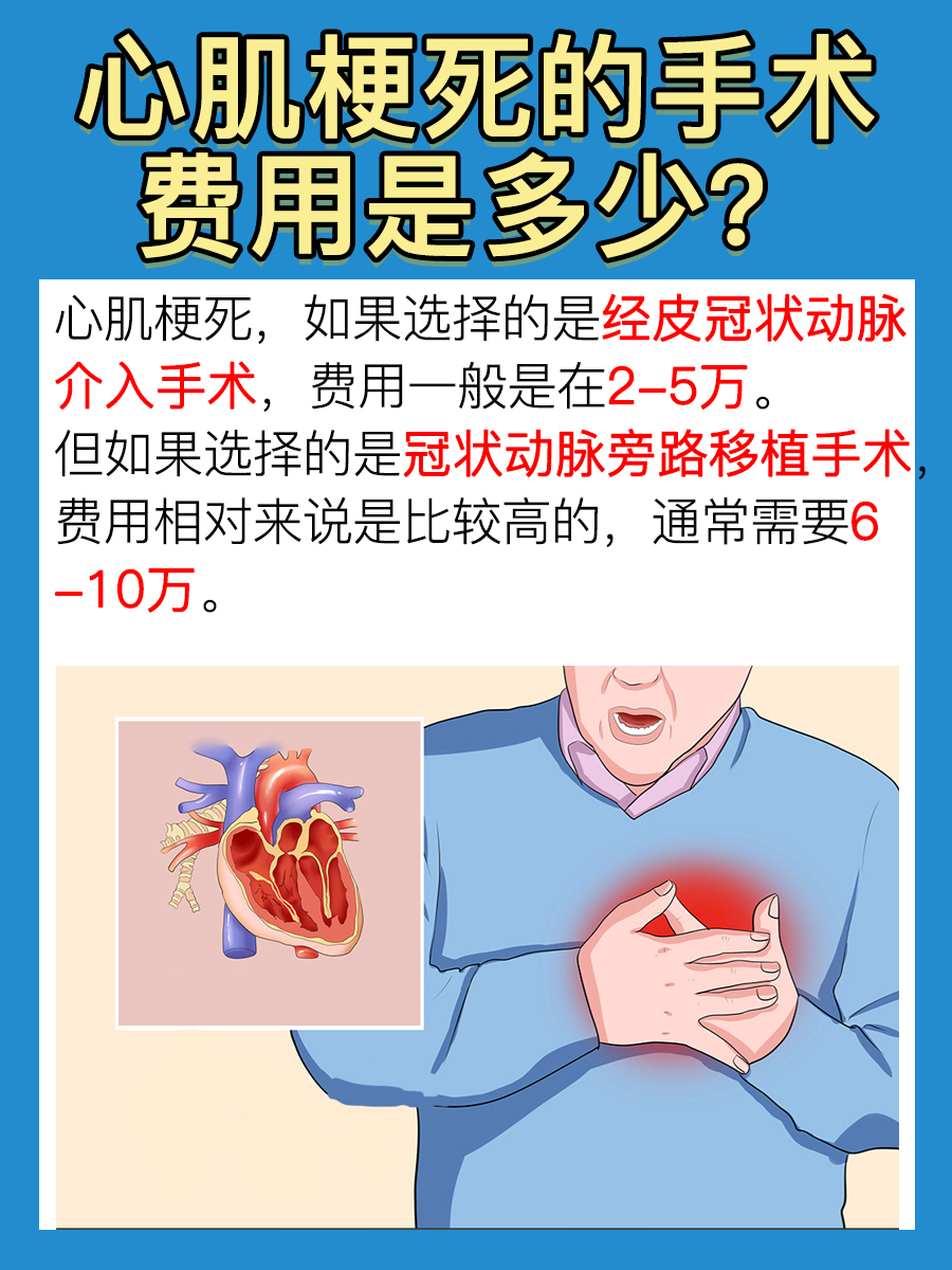 心梗手术的费用你了解吗?速来围观
