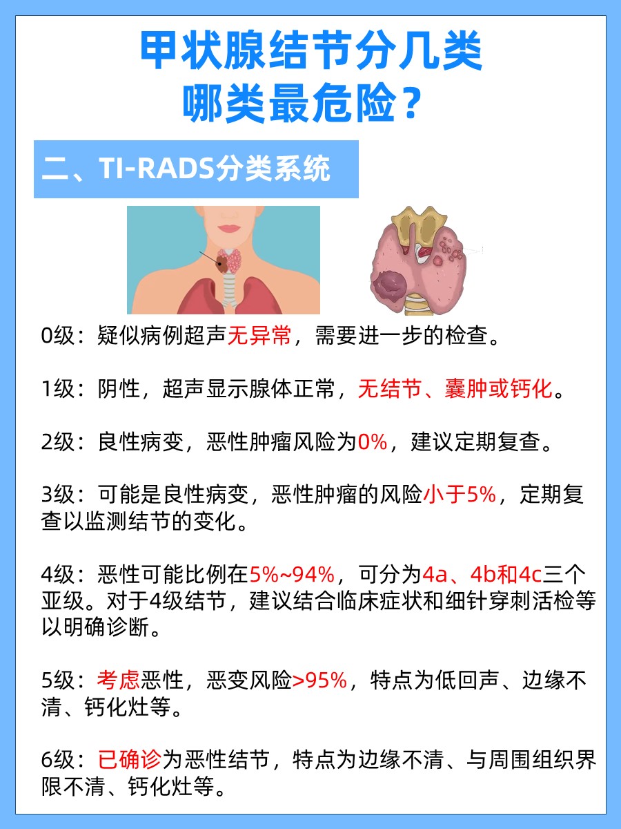 甲状腺结节分几类，哪类最危险？你了解多少？