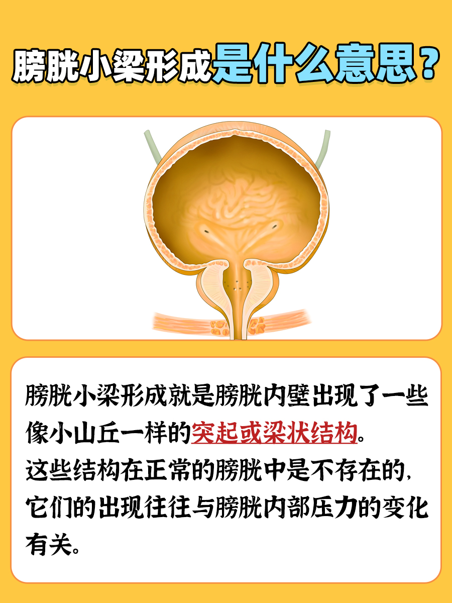 膀胱小梁形成：揭秘原因与应对策略