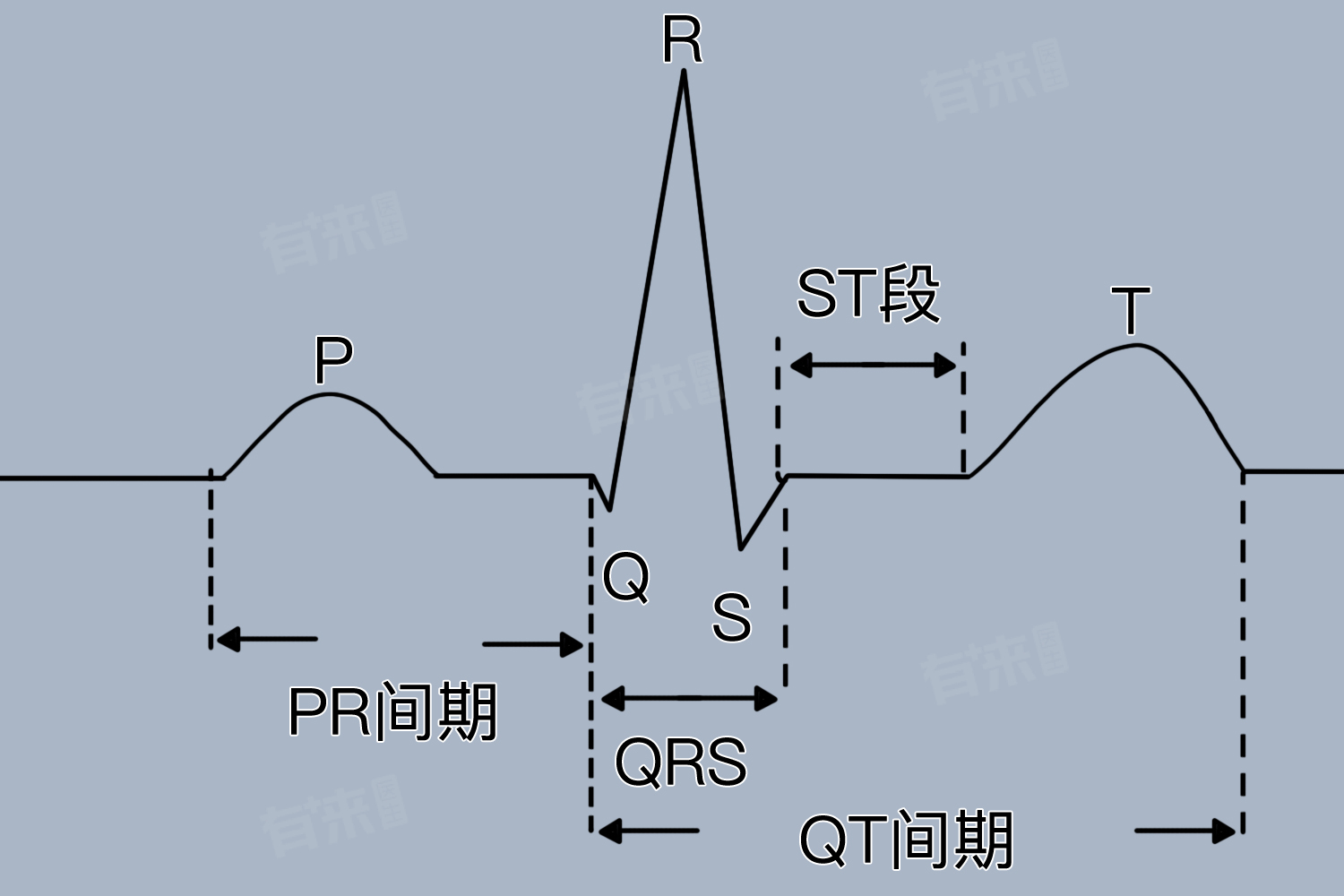 短pr间期是什么意思