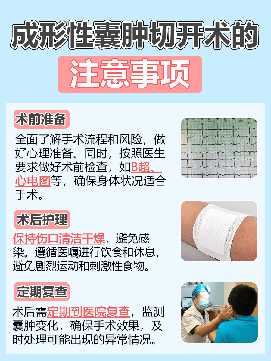 成形性囊肿切开术？全面剖析利与弊，值得一看！