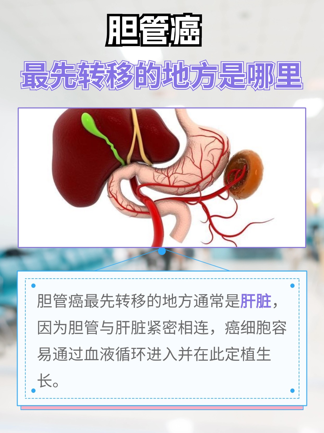 胆管癌患者必读：了解转移的早期信号
