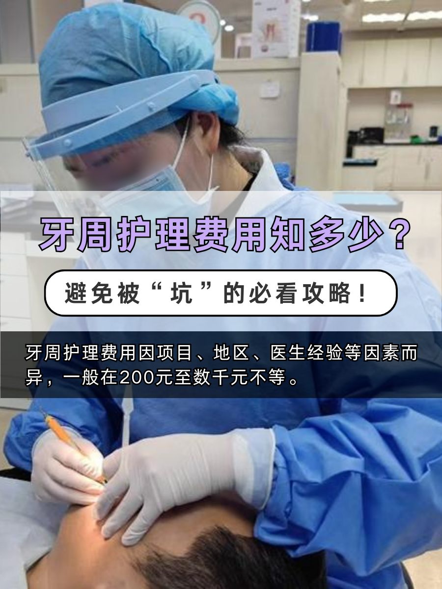 牙周护理费用知多少？避免被“坑”的必看攻略！