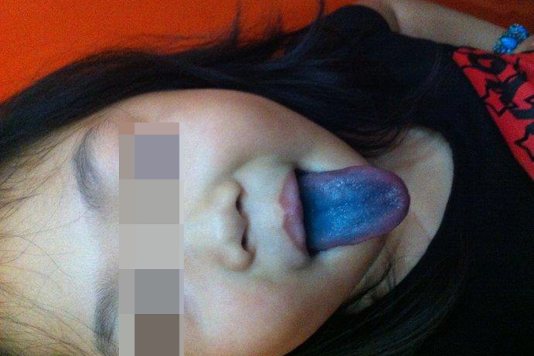 染苔致舌苔发蓝图