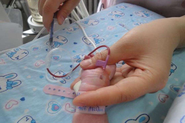 新生儿动脉采血定位图