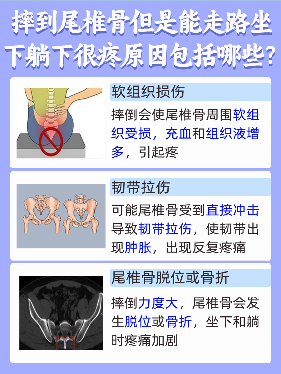 查看：摔到尾椎骨但是能走路坐下躺下很疼什么原因？