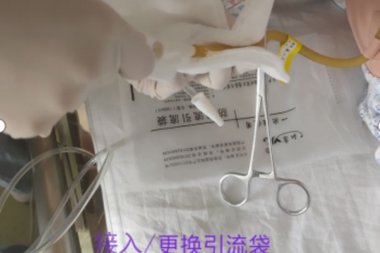 连接引流袋步骤图