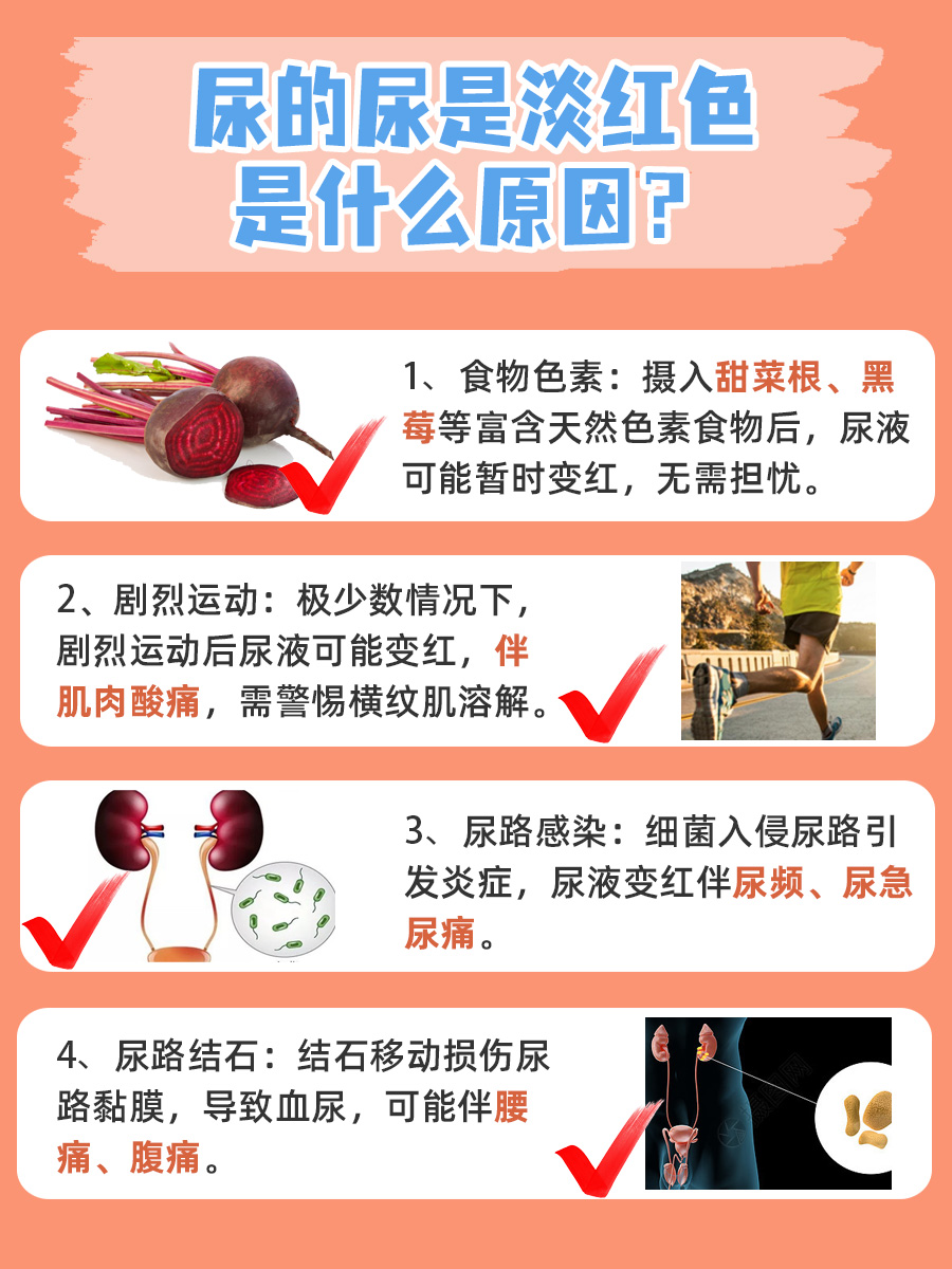 尿的尿是淡红色：带你了解病因