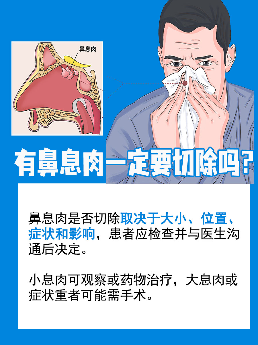 鼻息肉处理指南：是否必须切除