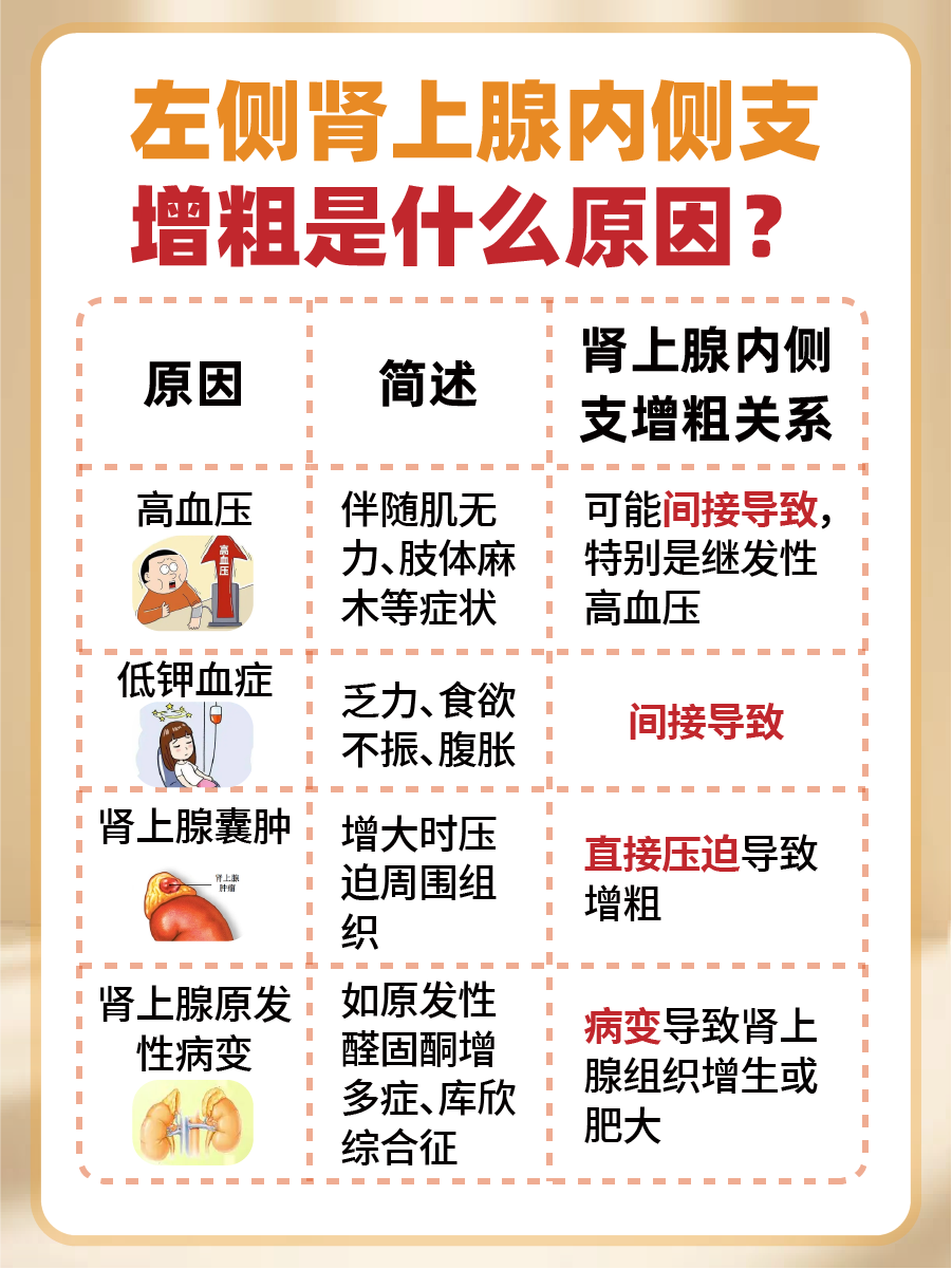 肾上腺小秘密:为何左侧内侧支悄悄变粗了?