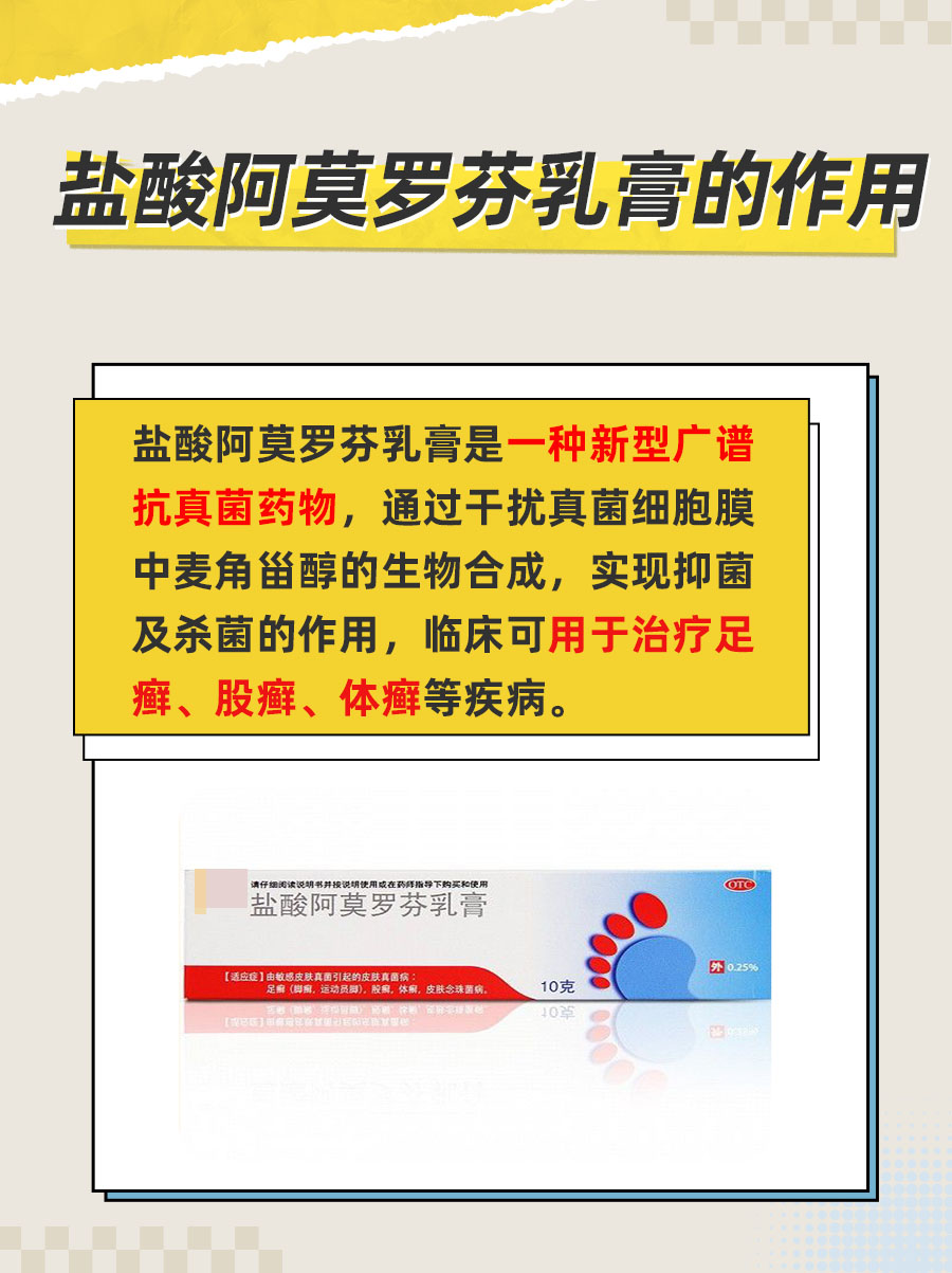 足癣!涂了6周的盐酸阿莫罗芬乳膏可以吗?