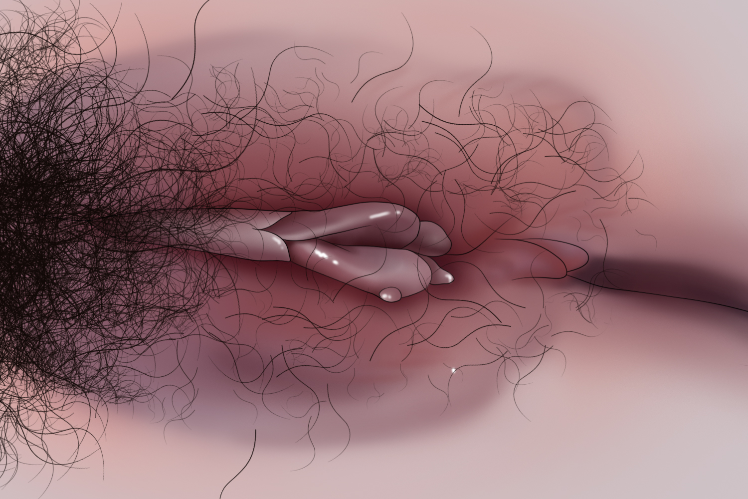 外阴湿疹图 外阴湿疹图