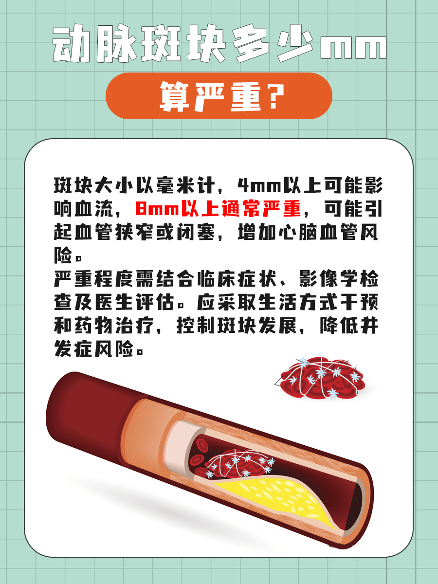 动脉斑块严重程度判断：多少mm算严重？