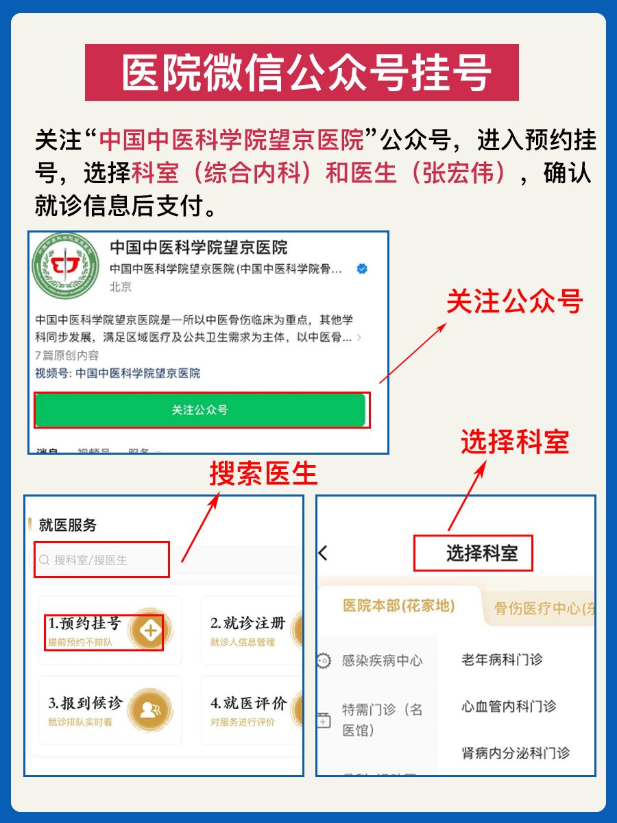 北京望京医院张宏伟医生怎么样？怎么挂号？
