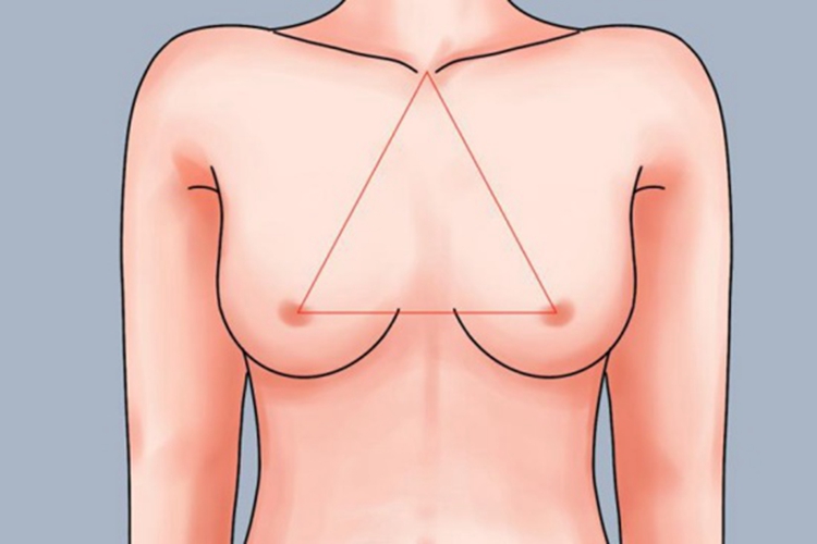 乳头内陷术后对称图