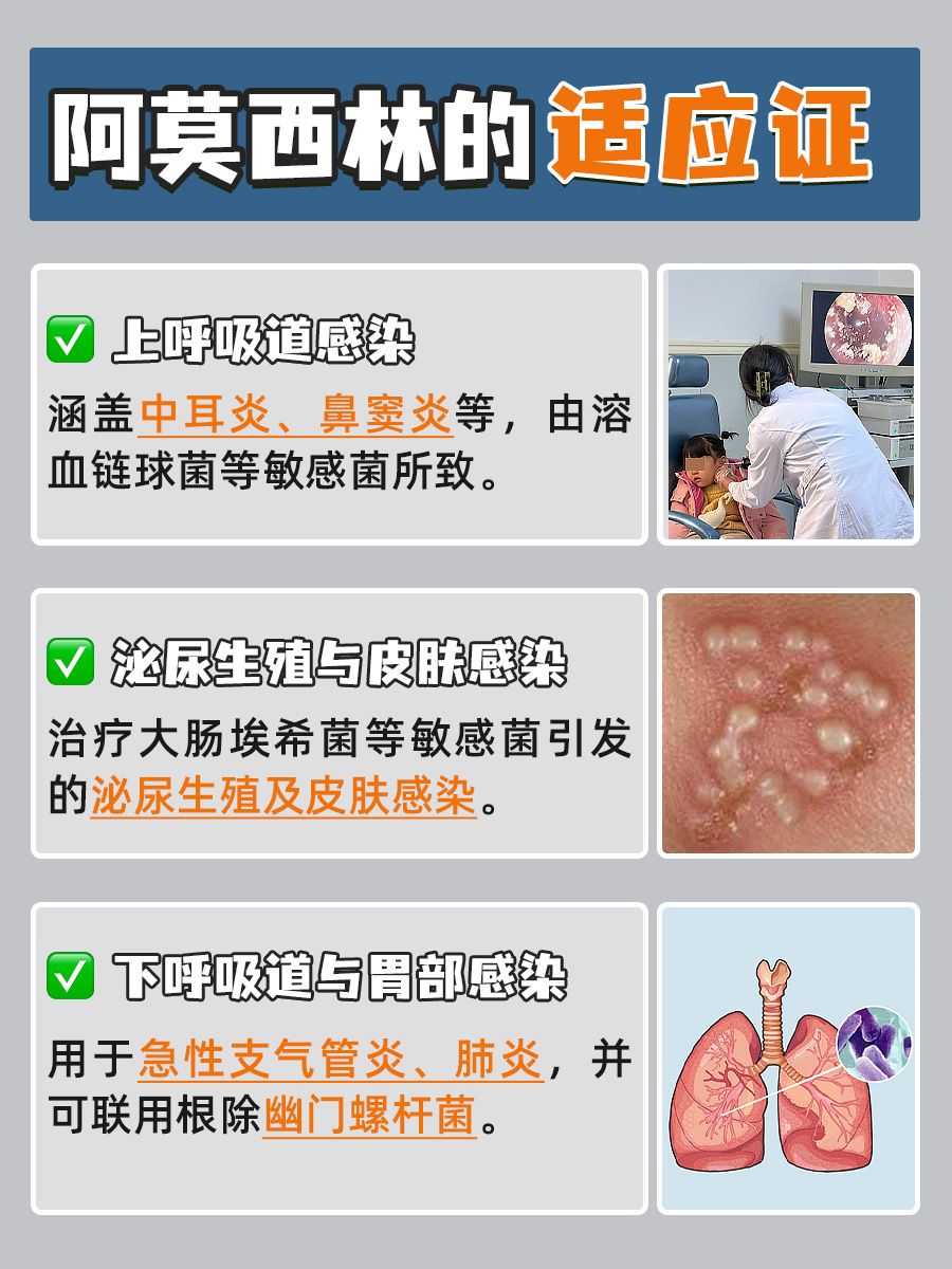 解锁阿莫西林正确吃法，一次几粒有讲究