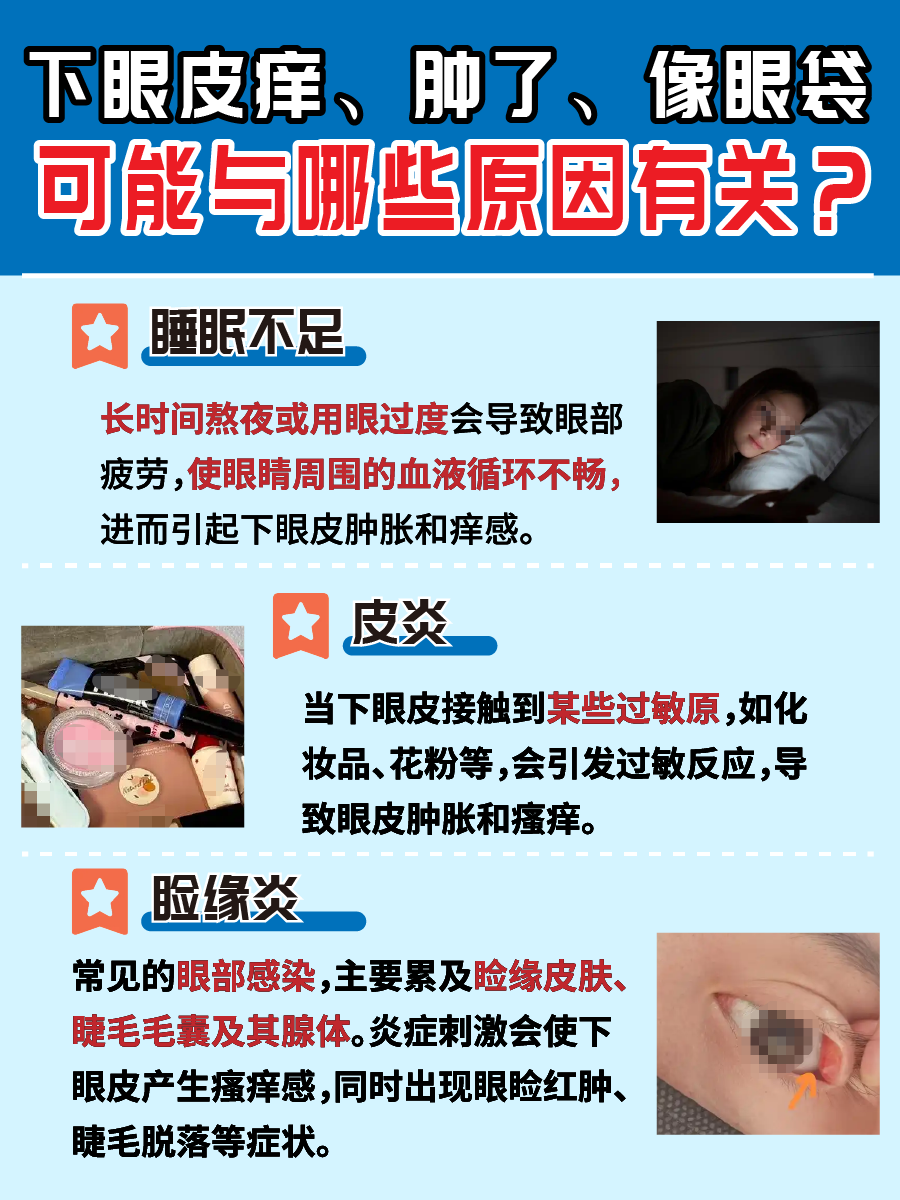 下眼皮痒、肿，像眼袋一样，这是怎么回事？