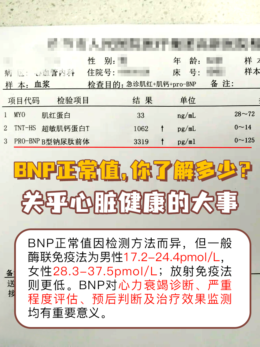 BNP正常值，你了解多少？关乎心脏健康的大事