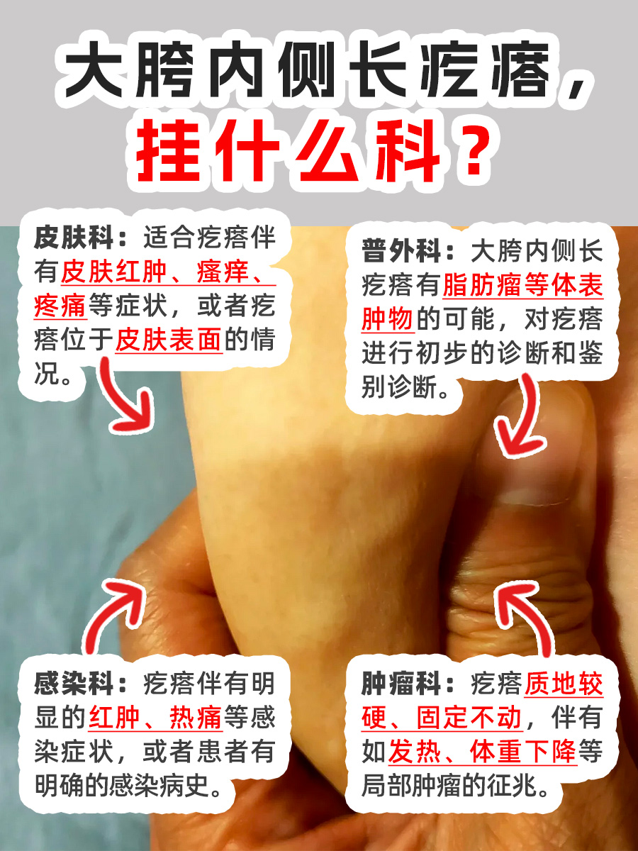 大胯内侧长疙瘩,找对科室是关键!