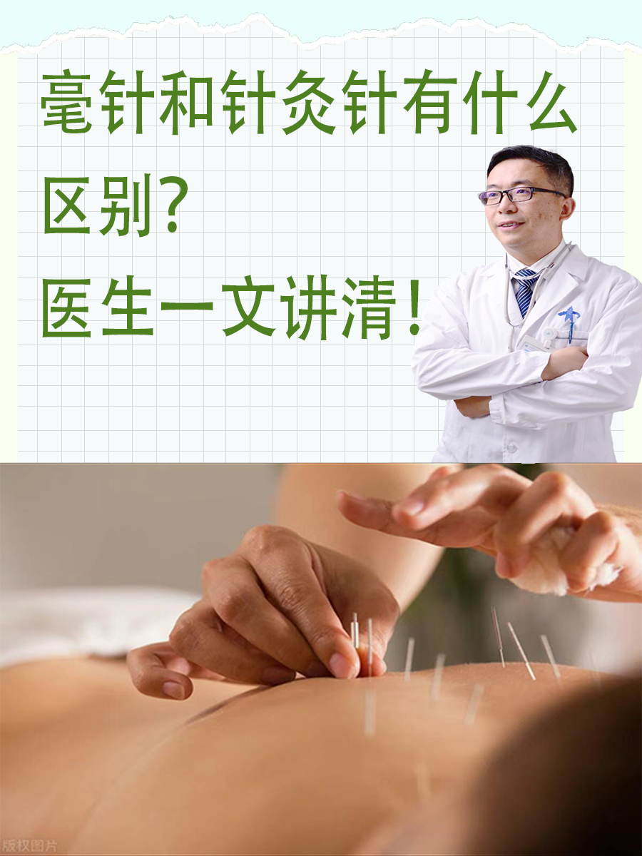毫针和针灸针有什么区别？医生一文讲清！