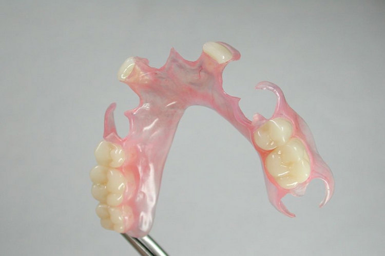 隐形活动假牙图 隐形活动假牙图