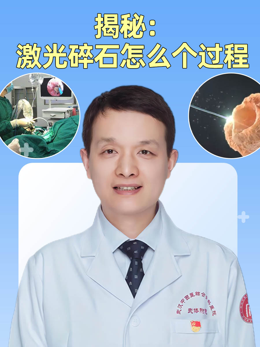 揭秘：激光碎石是怎么个过程