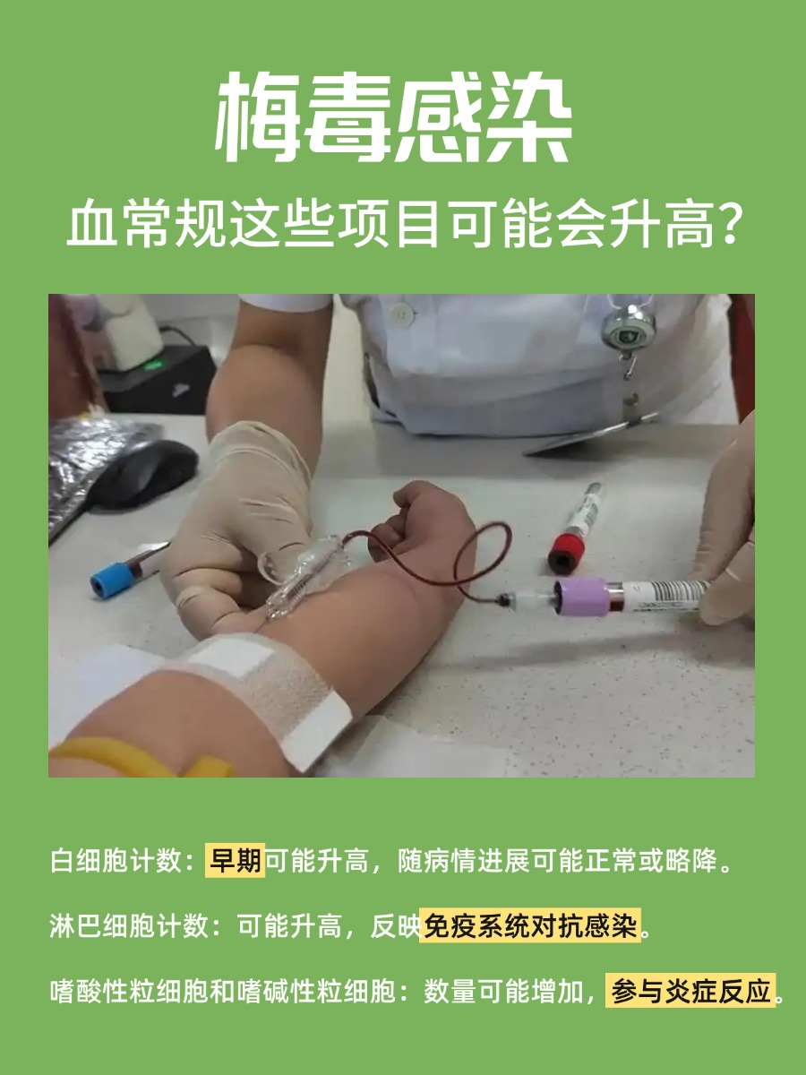 梅毒感染，血常规里这项悄悄涨