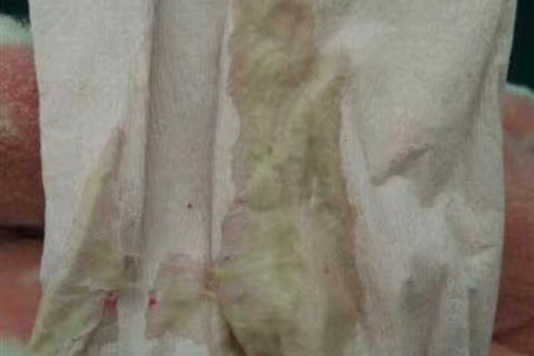 白色恶露颜色较白图