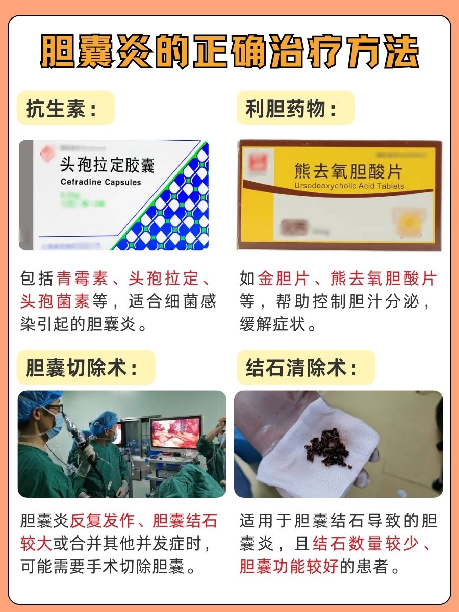 别上当！胆囊炎非煮鸡蛋沾腐乳汤可治