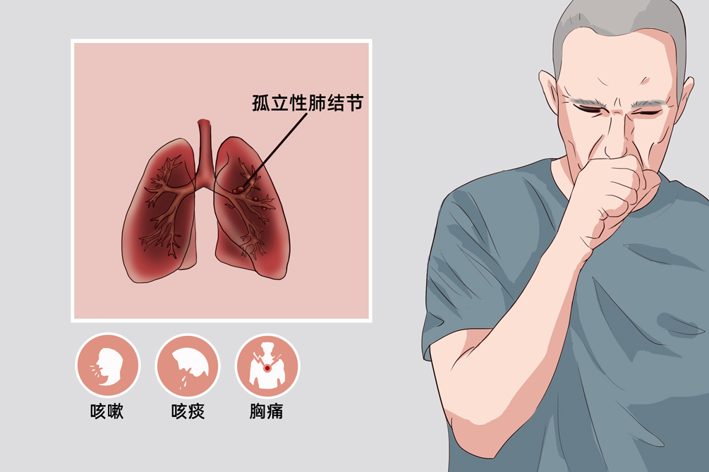 肺结节 卡通图图片