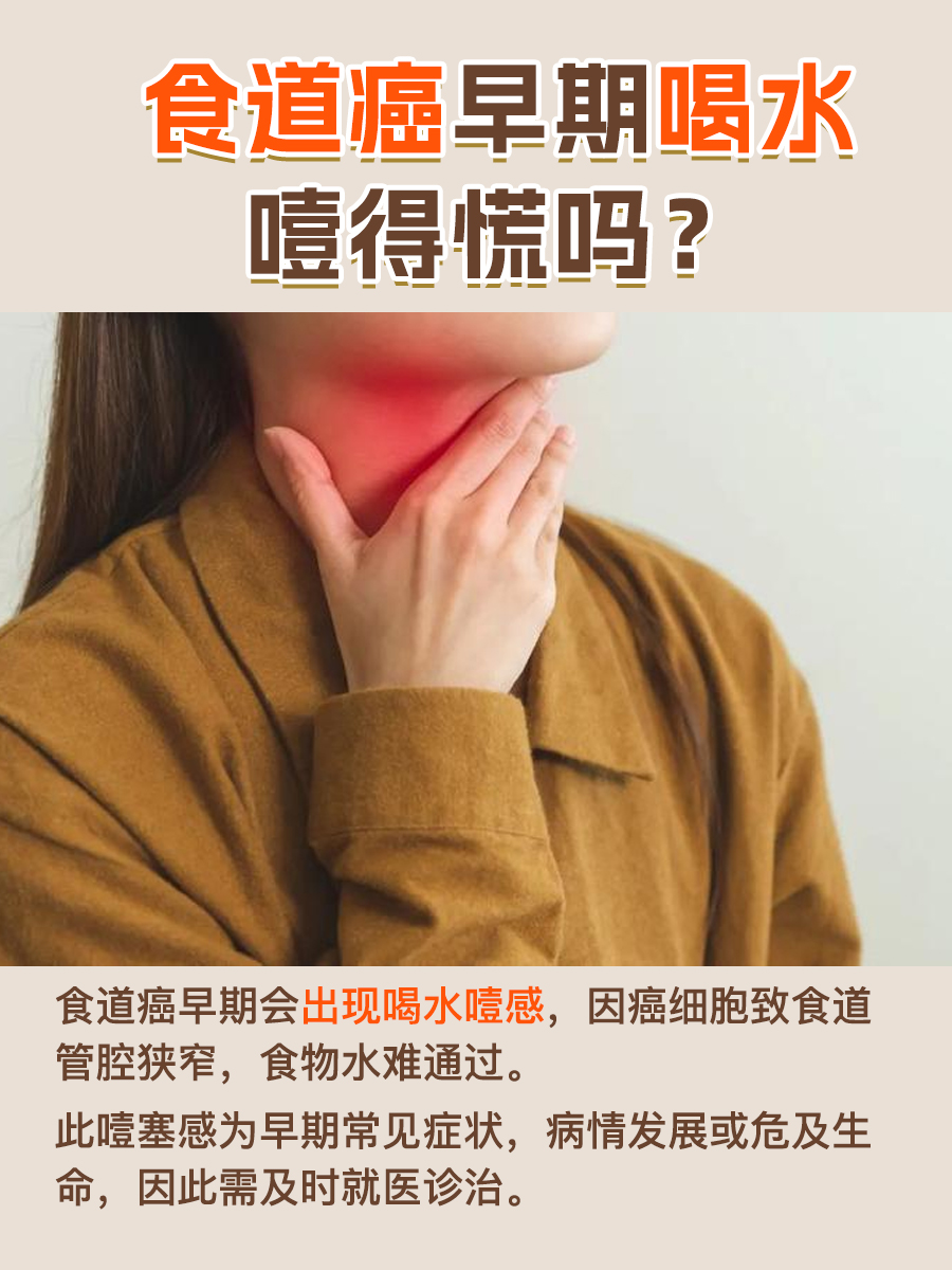 食道癌早期喝水噎得慌吗？一看便知