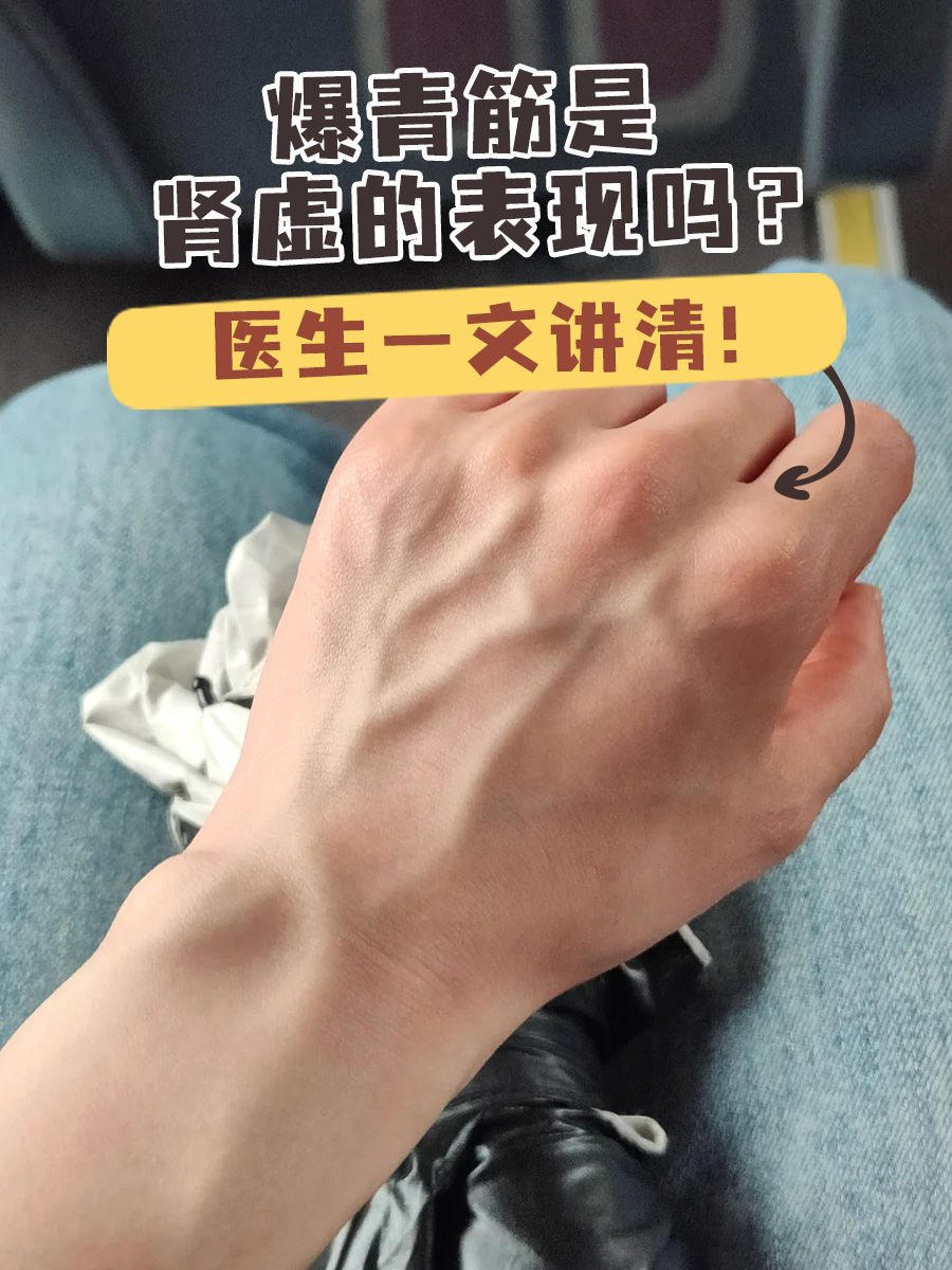 爆青筋是肾虚的表现吗？医生一文讲清！