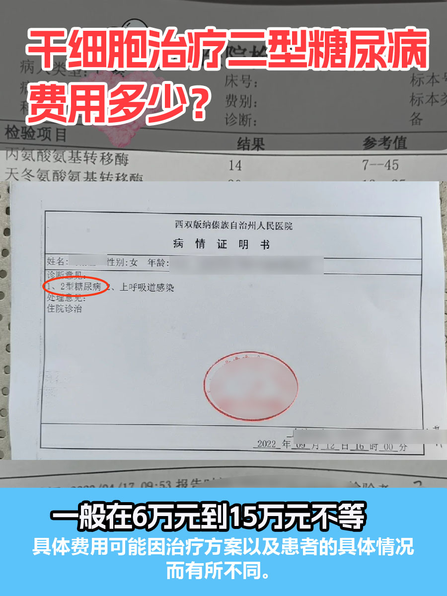 干细胞治疗二型糖尿病,费用多少?