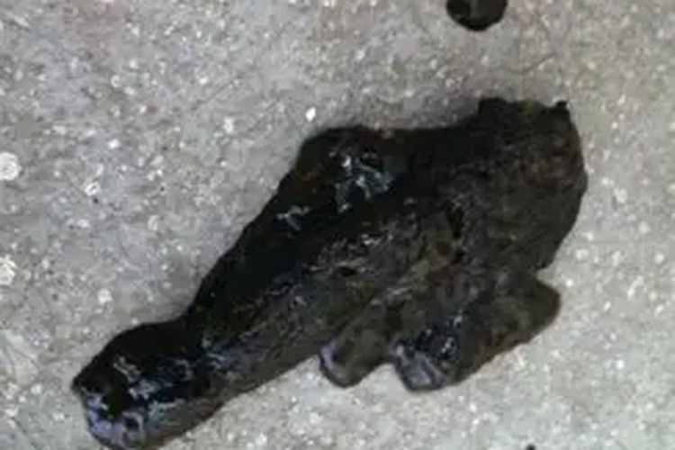 生理因素导致大便黑色图 生理因素导致大便黑色图