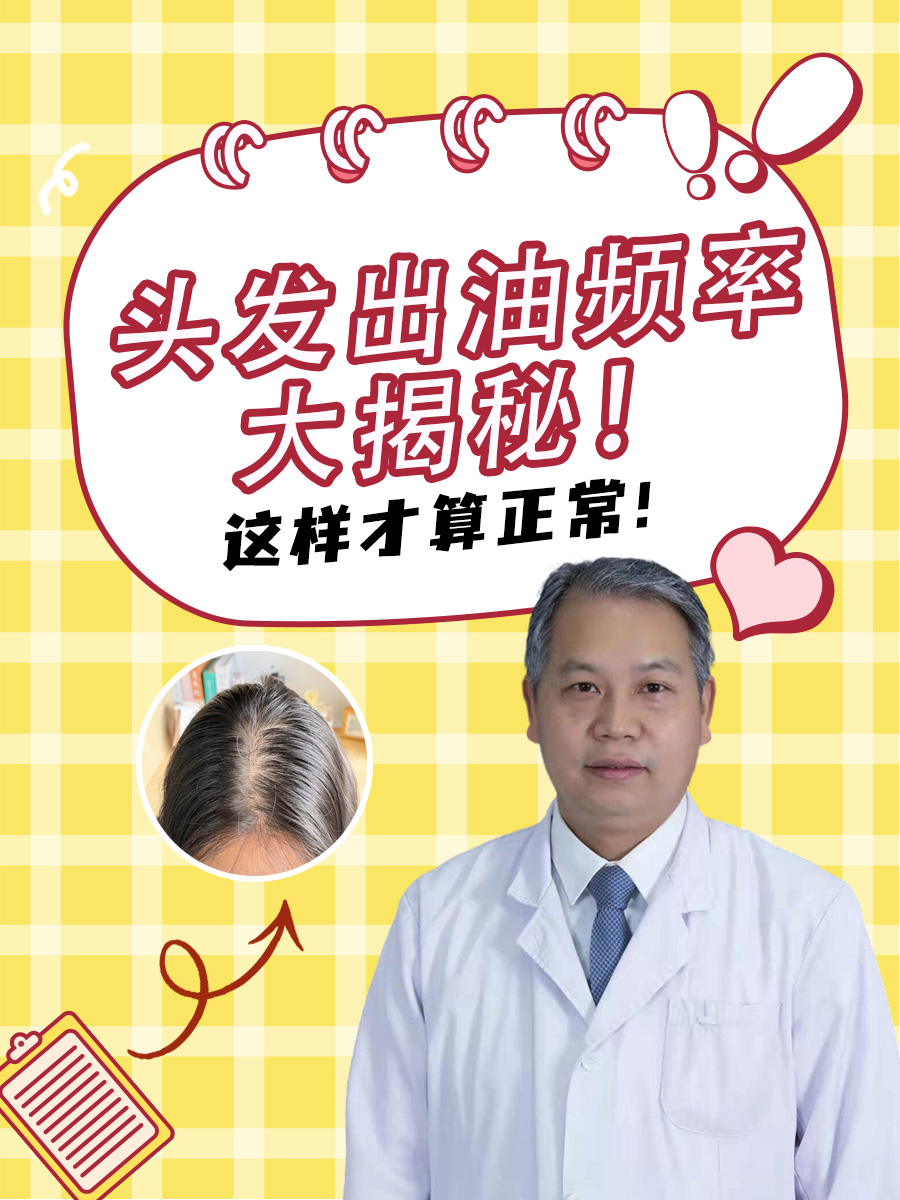头发出油频率大揭秘！这样才算正常！