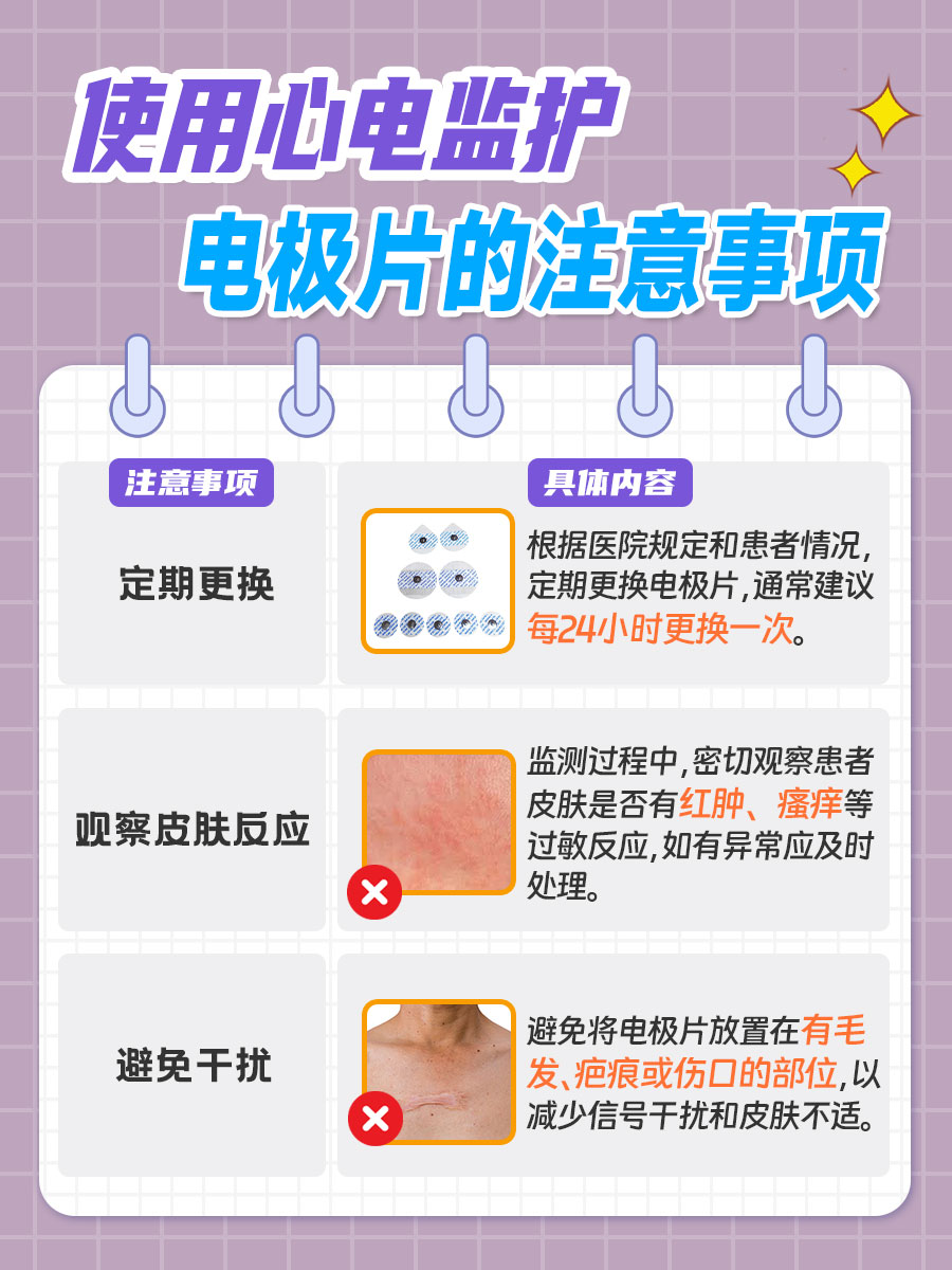 心电监护电极片位置图