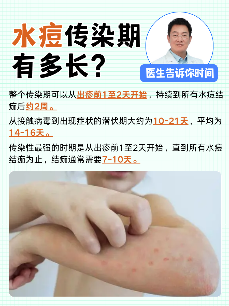 水痘传染期有多长?医生告诉你时间