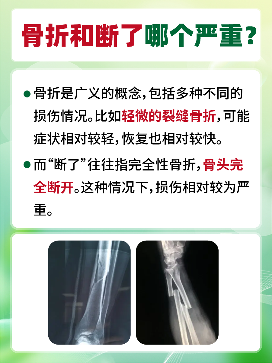 一文解析，骨折和断了哪个严重