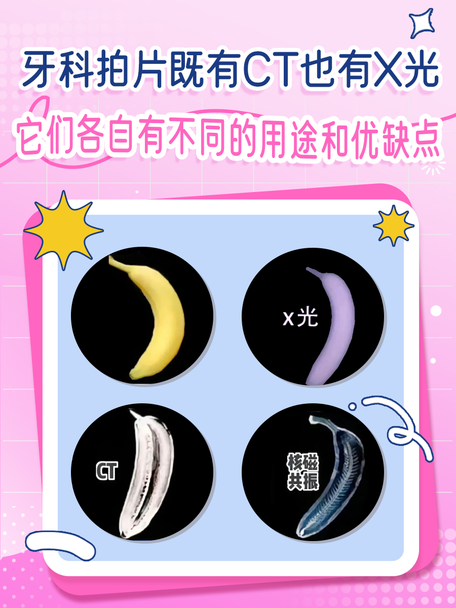牙科拍片揭秘：CT还是X光？你选对了吗？