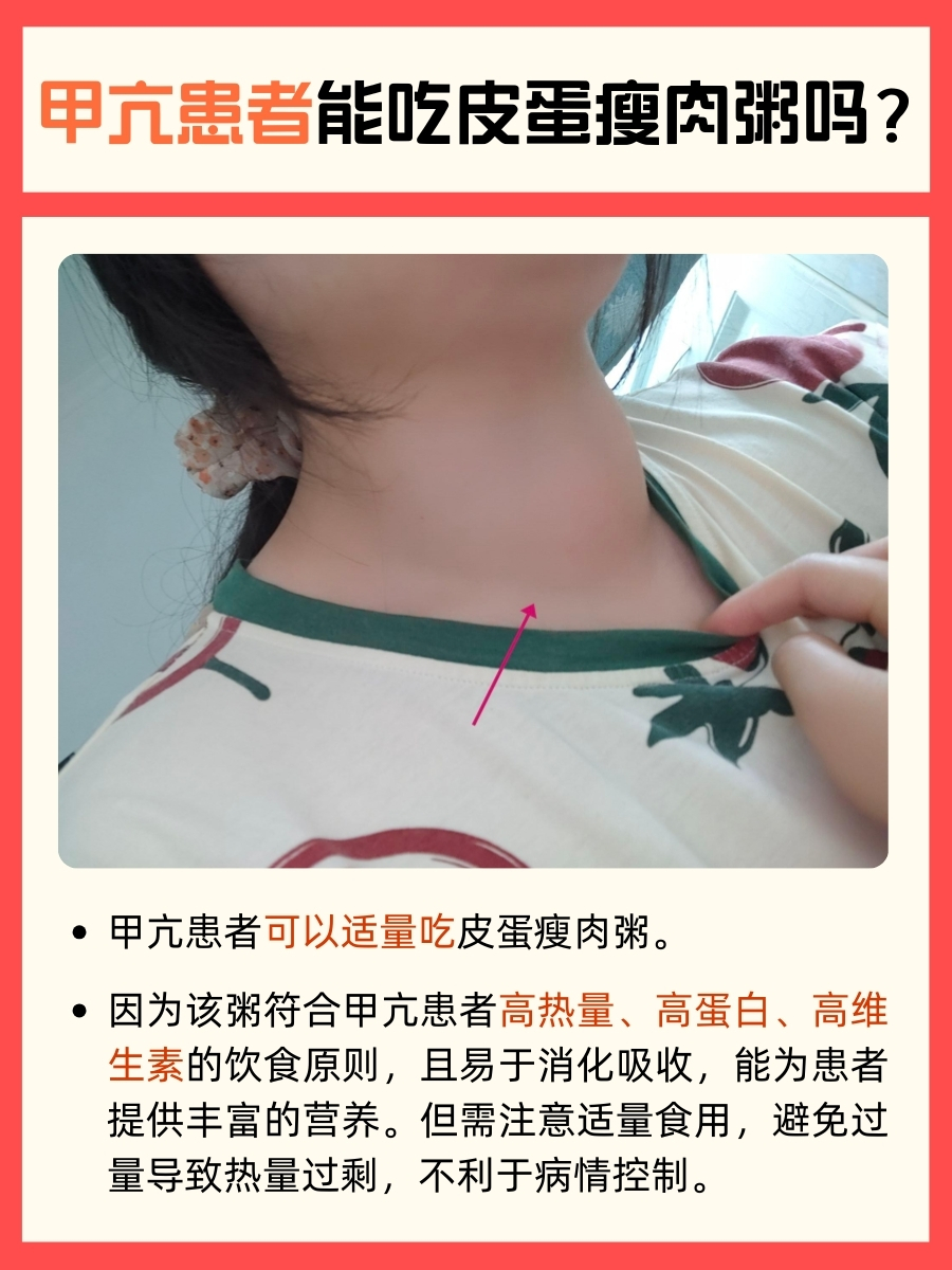 甲亢患者，可以吃皮蛋瘦肉粥吗？