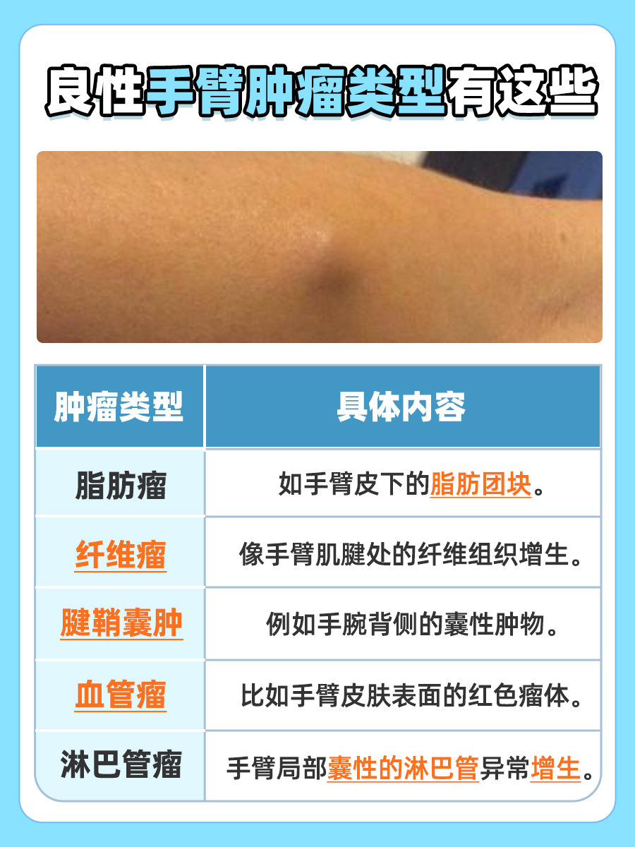 手臂肿瘤,一般良性多还是恶性多?