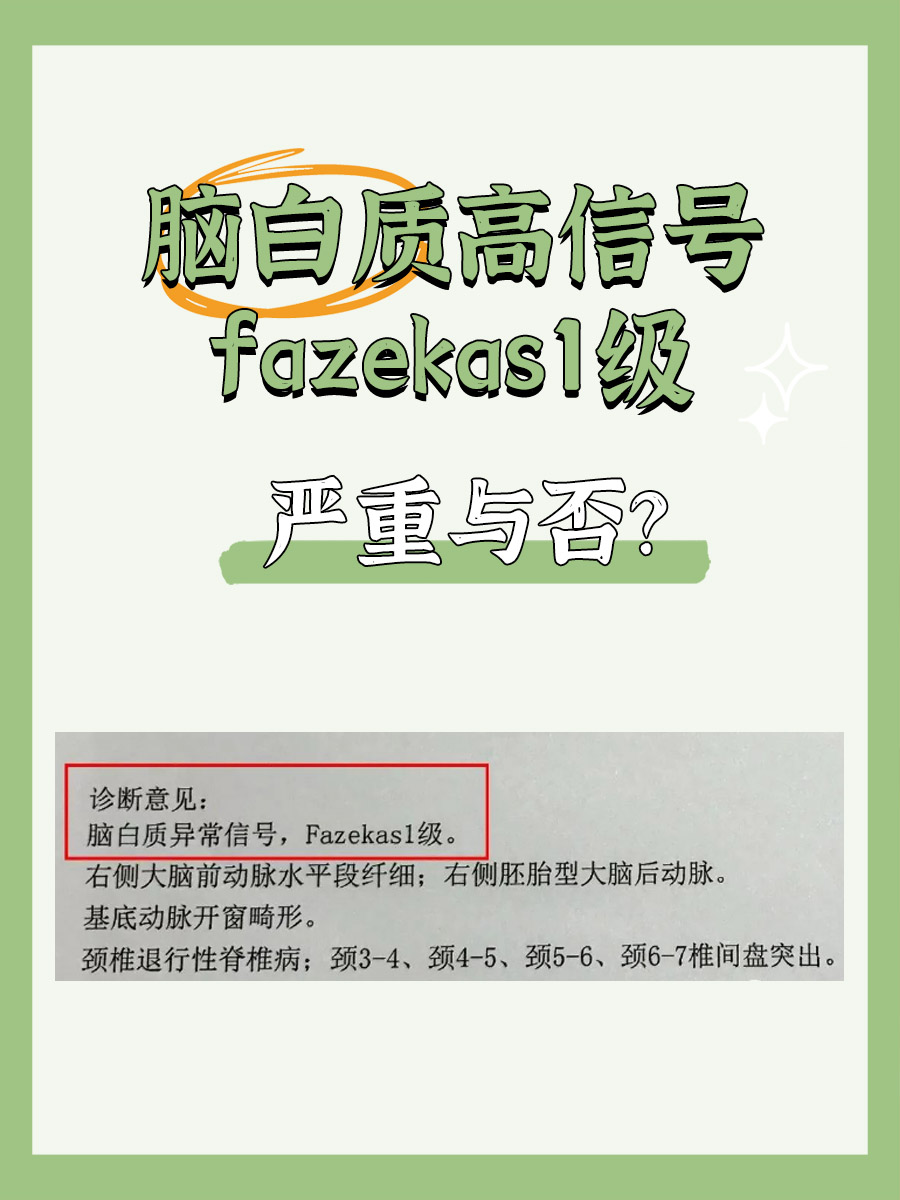 脑白质高信号fazekas1级，严重与否？